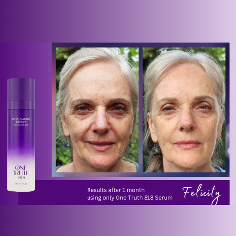 Before and after comparison of a woman’s face showing reduced wrinkles, smoother skin, and improved radiance after 1 month of using One Truth 818 Anti-Ageing Serum with TAM-818.
<a href="/home"><img src="Square_Photo_of_Before_and_After_1" alt="One Truth 818 Before and Afters"></a>